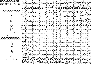 \begin{figure}
\begin{center}
\unitlength=0.24pt
\begin{picture}
(1649,1164)
\put(0,1164){\special{em: graph fig10.pcx}}\end{picture}\end{center}\end{figure}