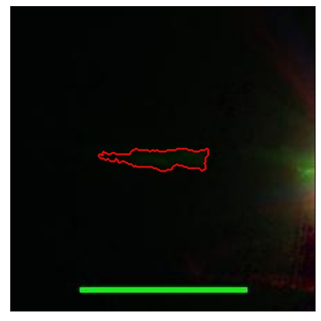 2515_038.0_contour_r